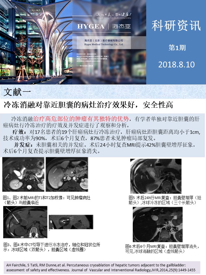 【海杰亞科研資訊】第1期——肝、肺癌消融